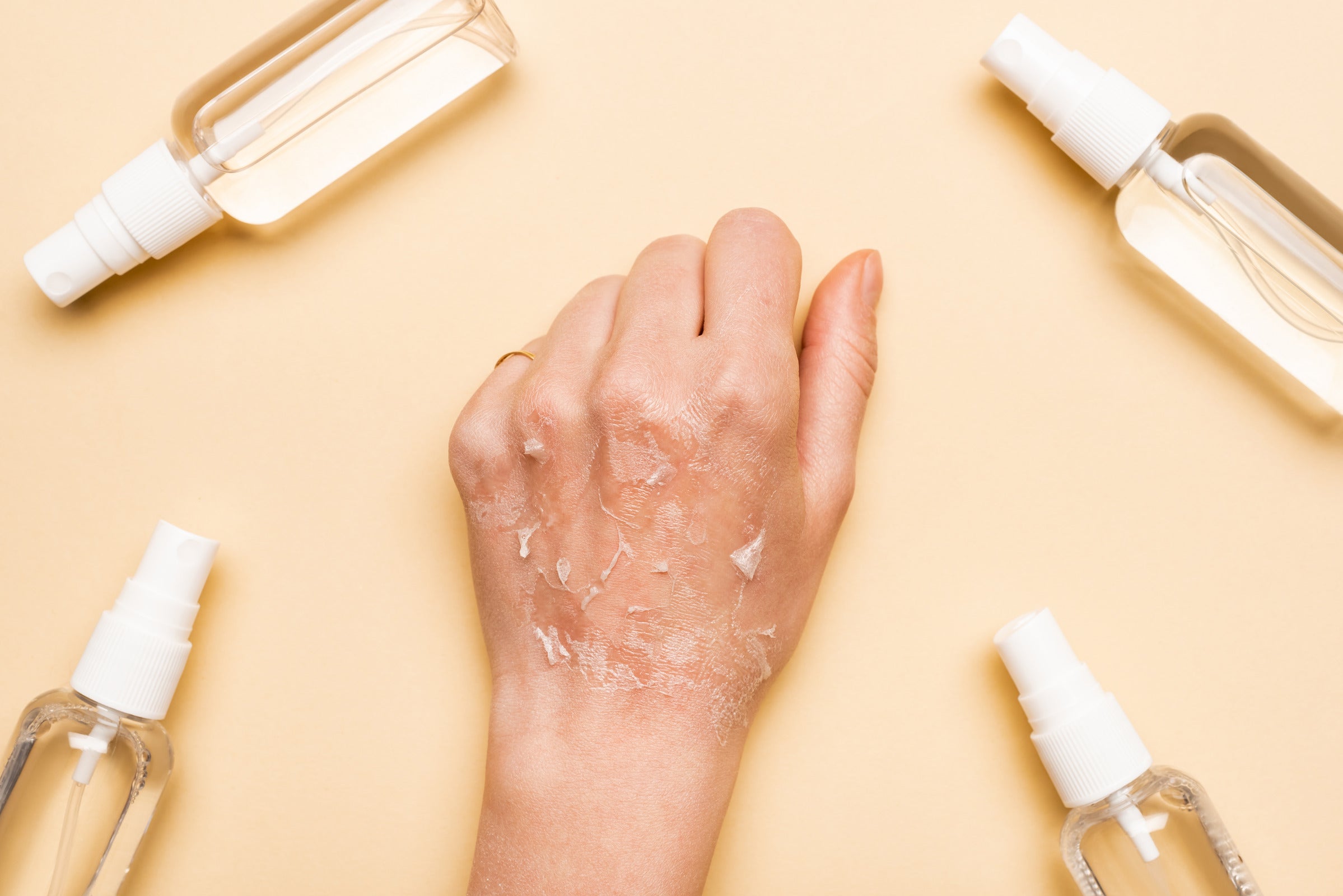 5 Tips and Mistakes on Disinfecting Wounds with Hand Sanitizer