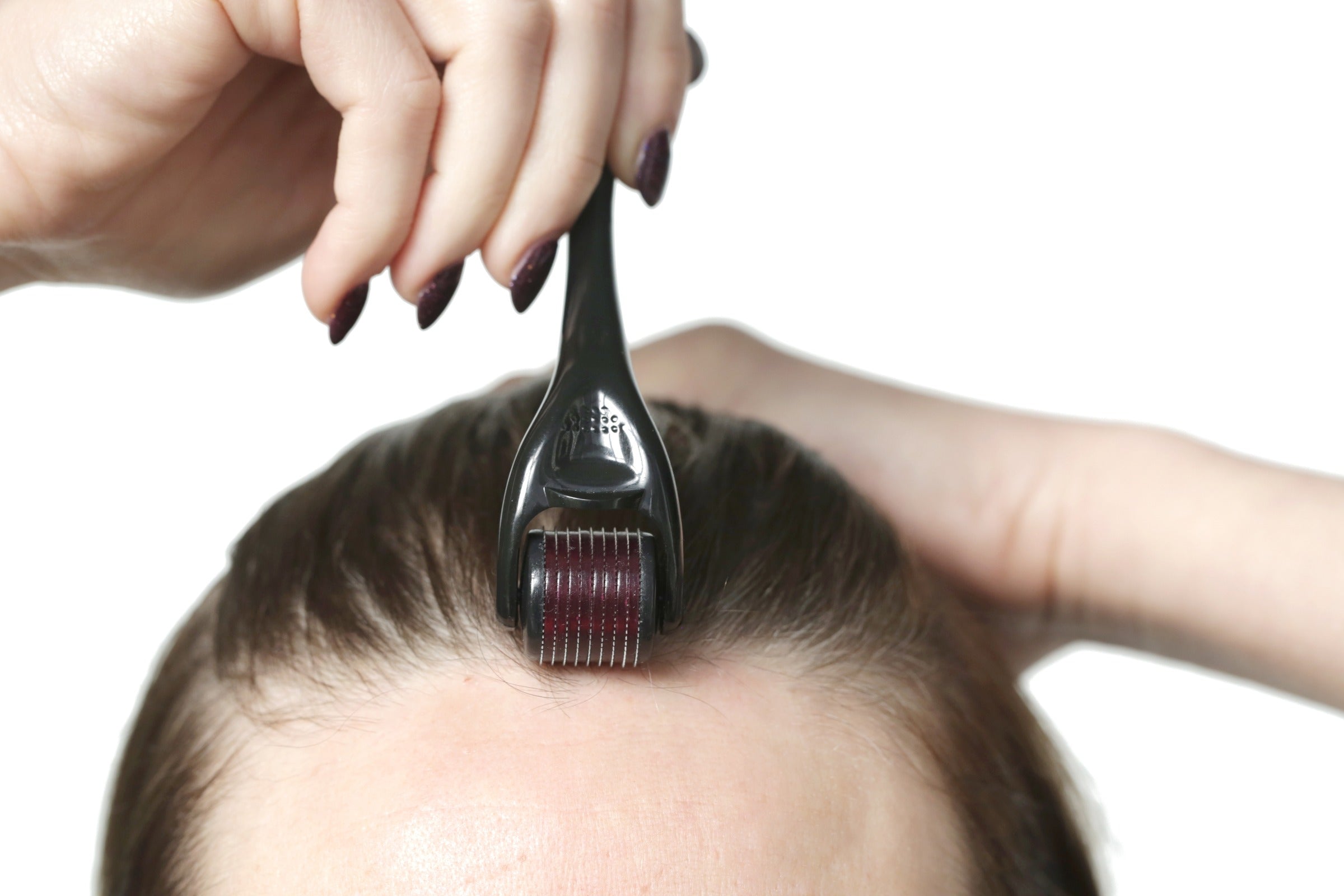 3 Benefits of Using a Derma Roller for Hair Growth