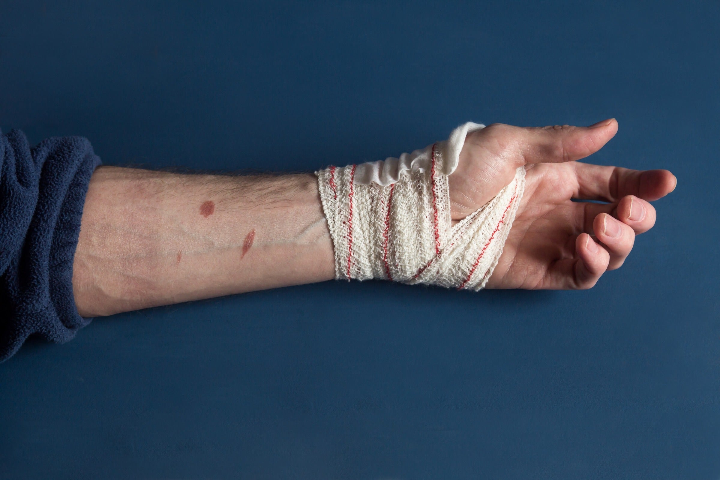 The benefits and risks of fasting for wound healing