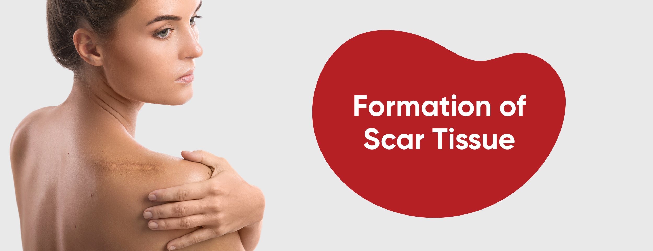 The formation of scar tissue