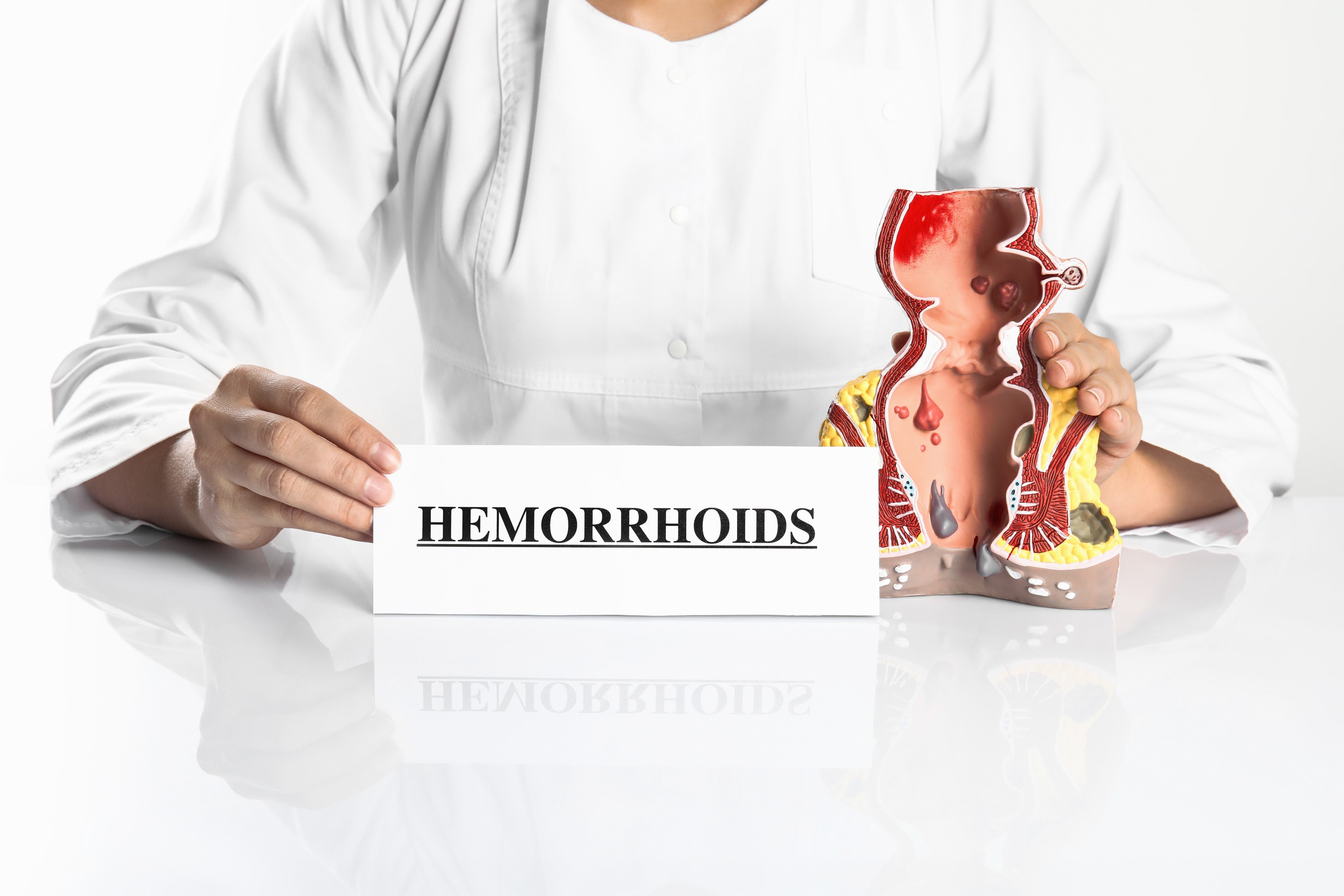 External hemorrhoids that are bleeding can be treated after they burst