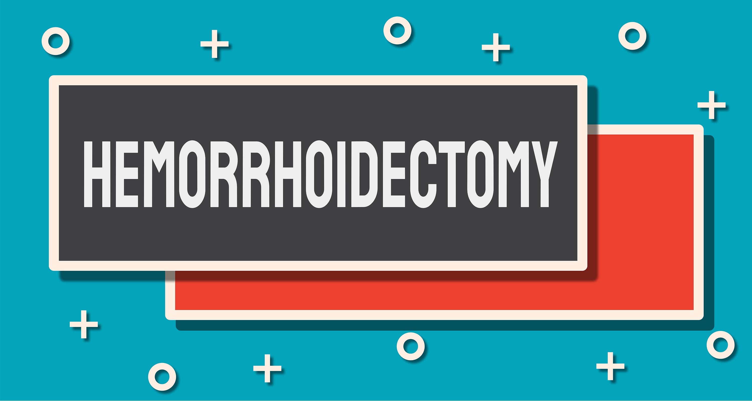 A hemorrhoidectomy is a procedure for removing hemorrhoids inside the body
