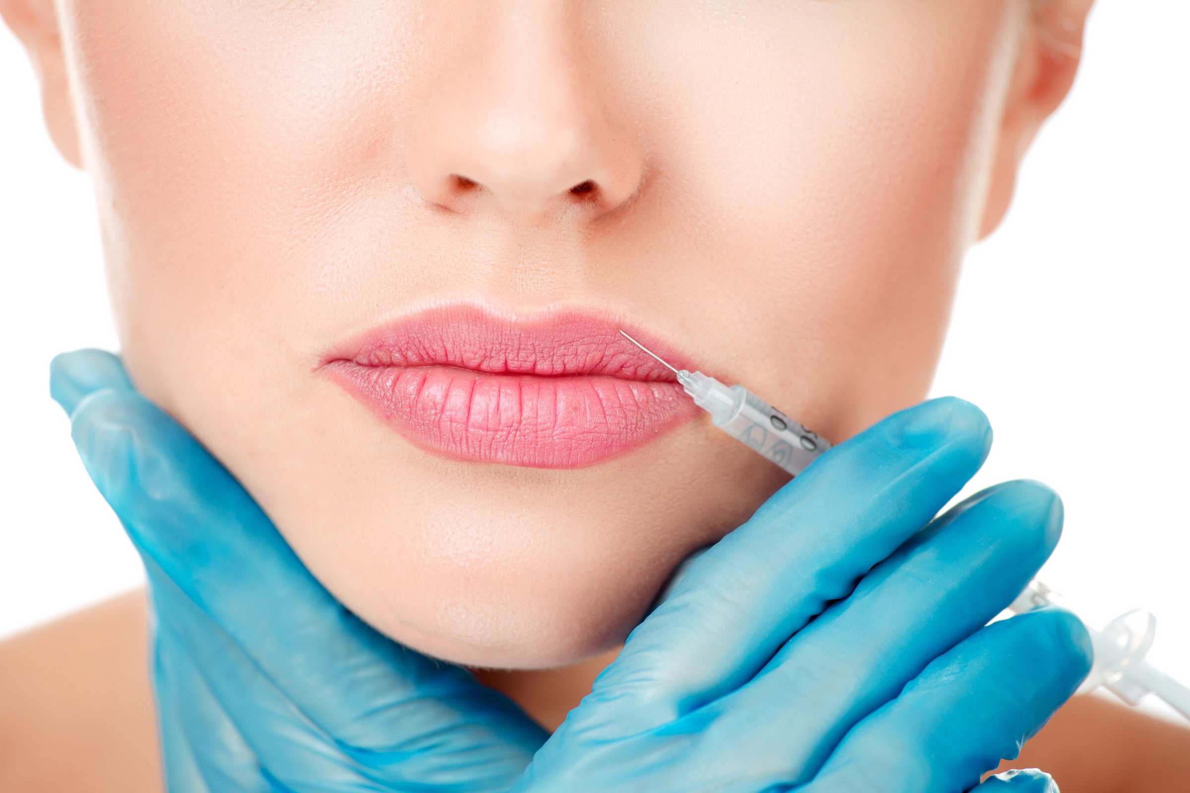 Five Steps for Injecting Fat into Your Lips