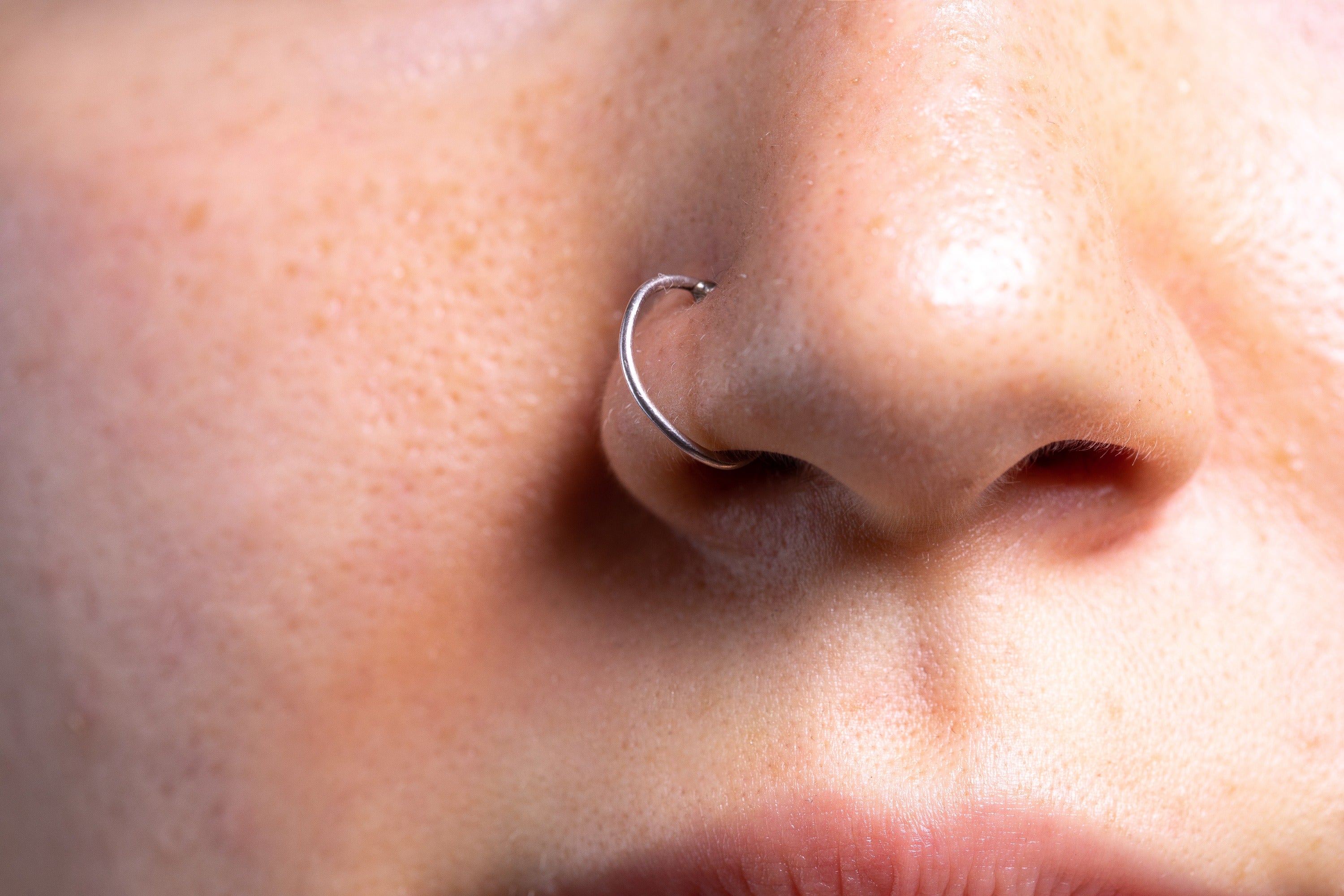 9 Fast Ways to Get Rid of Nose Piercing Bump
