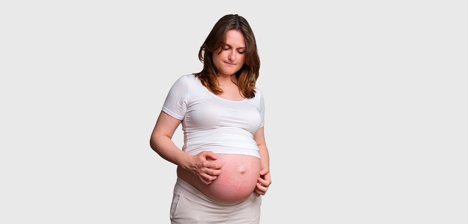 Intrahepatic Cholestasis of Pregnancy