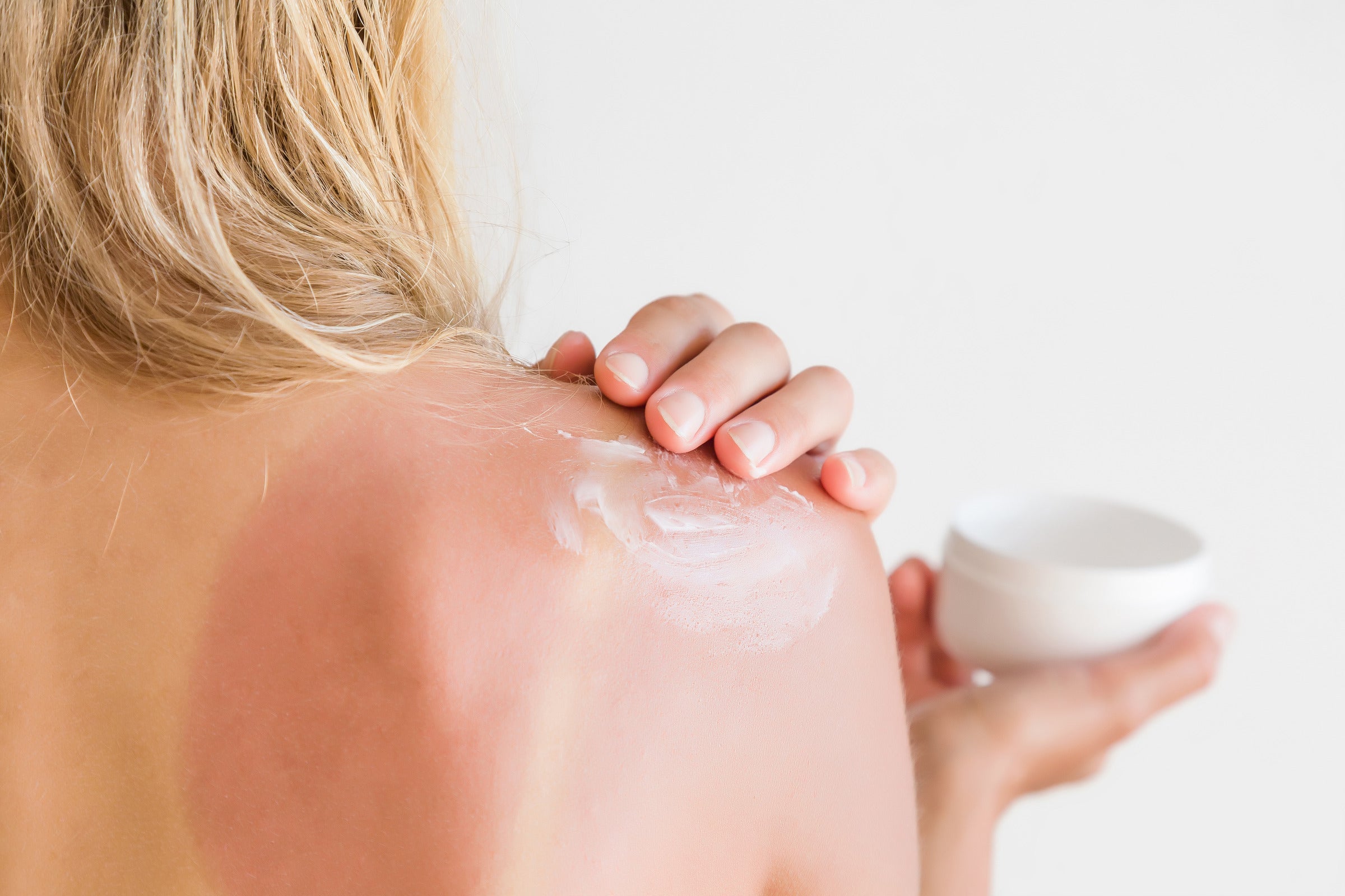 UV Sensitivity and Spray Tan