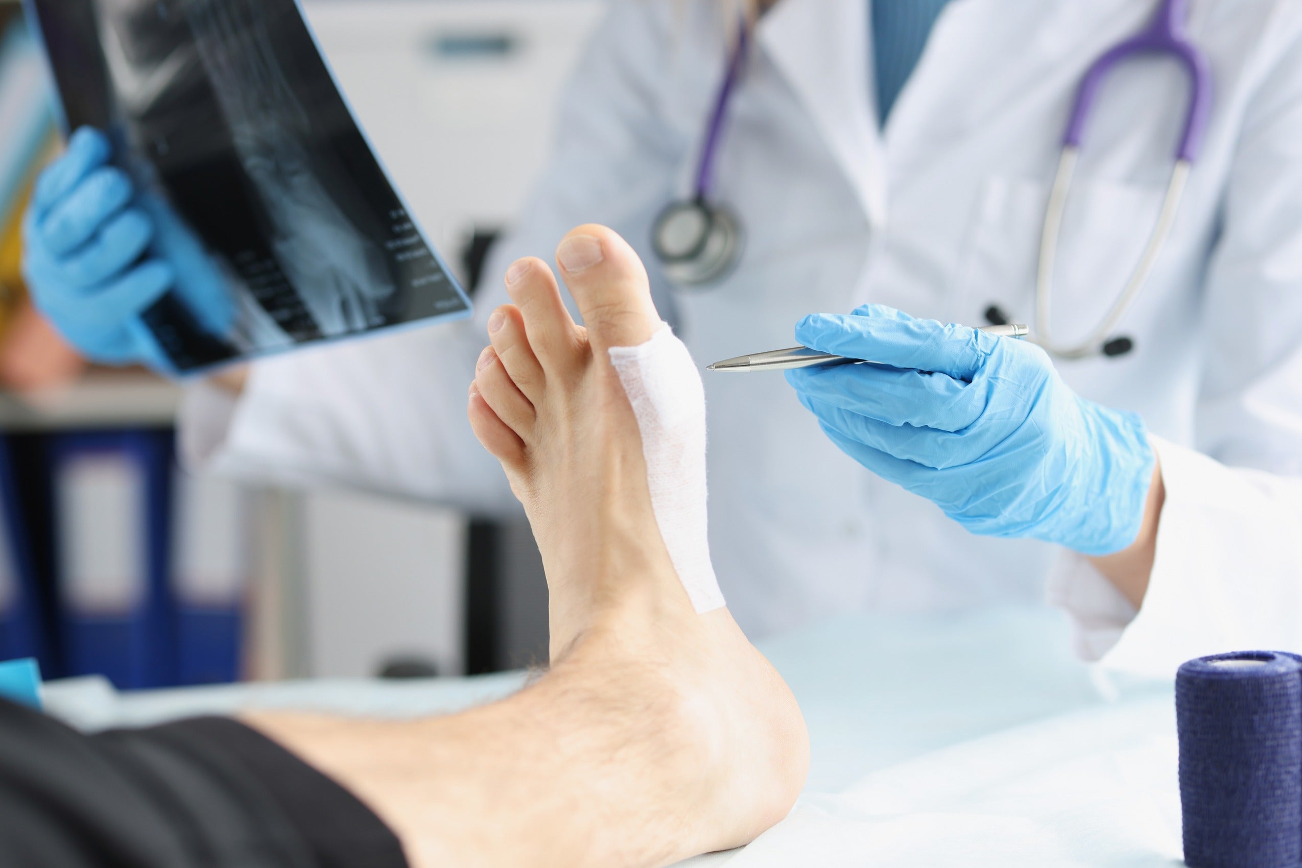 Keep Feet Inspected Daily for  Preventions of Diabetic Wounds