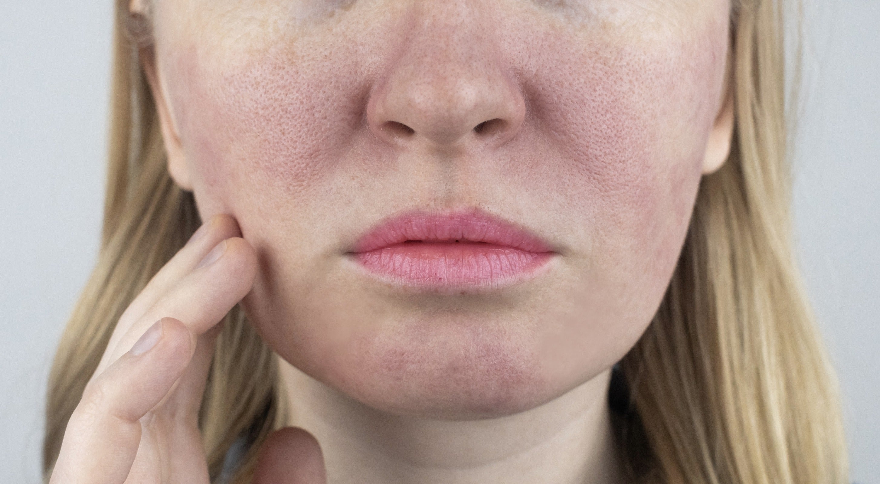 The 12 Best Tips To Get Rid of Large Pores