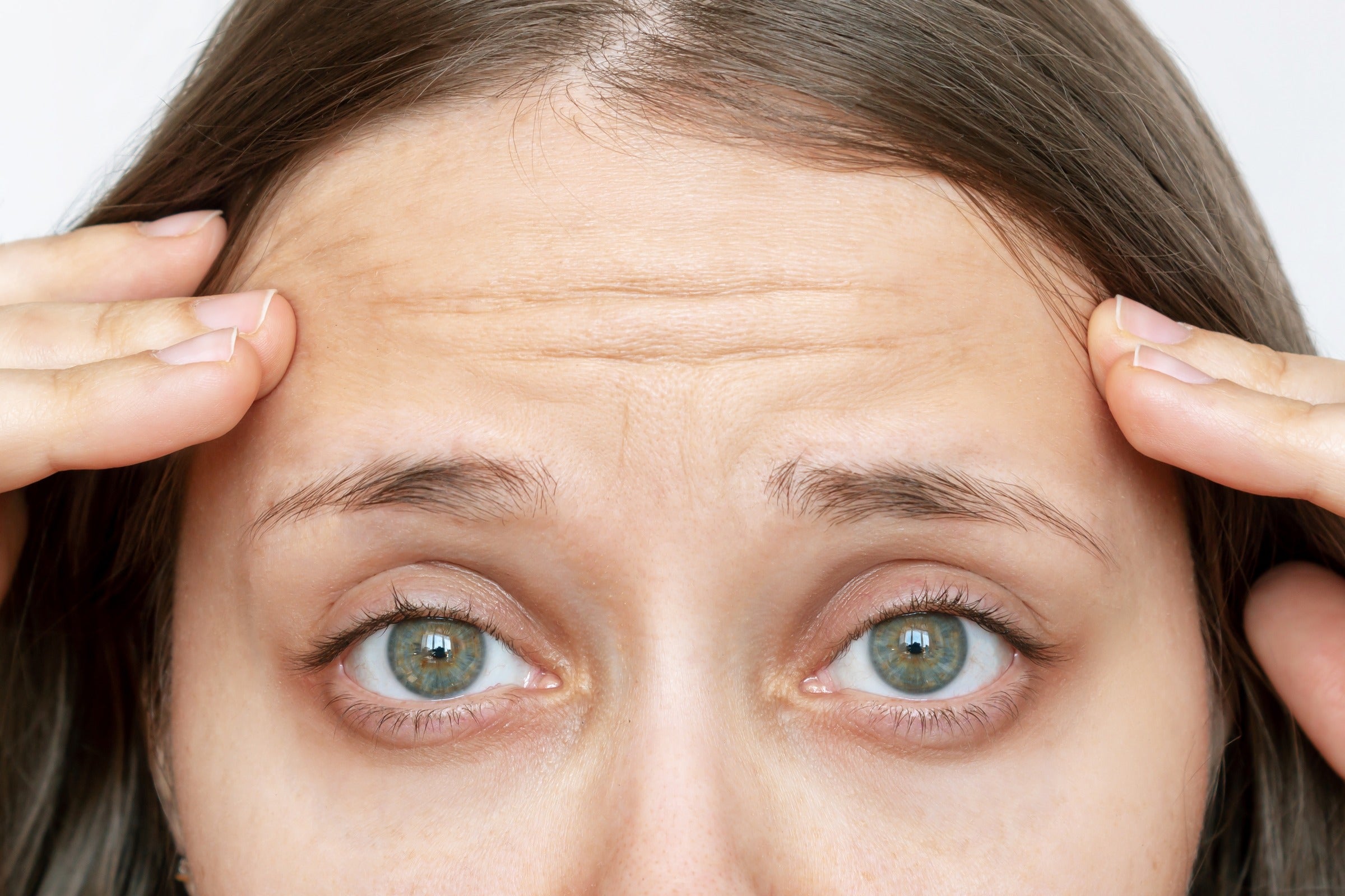 The long-term impact of Botox on the forehead