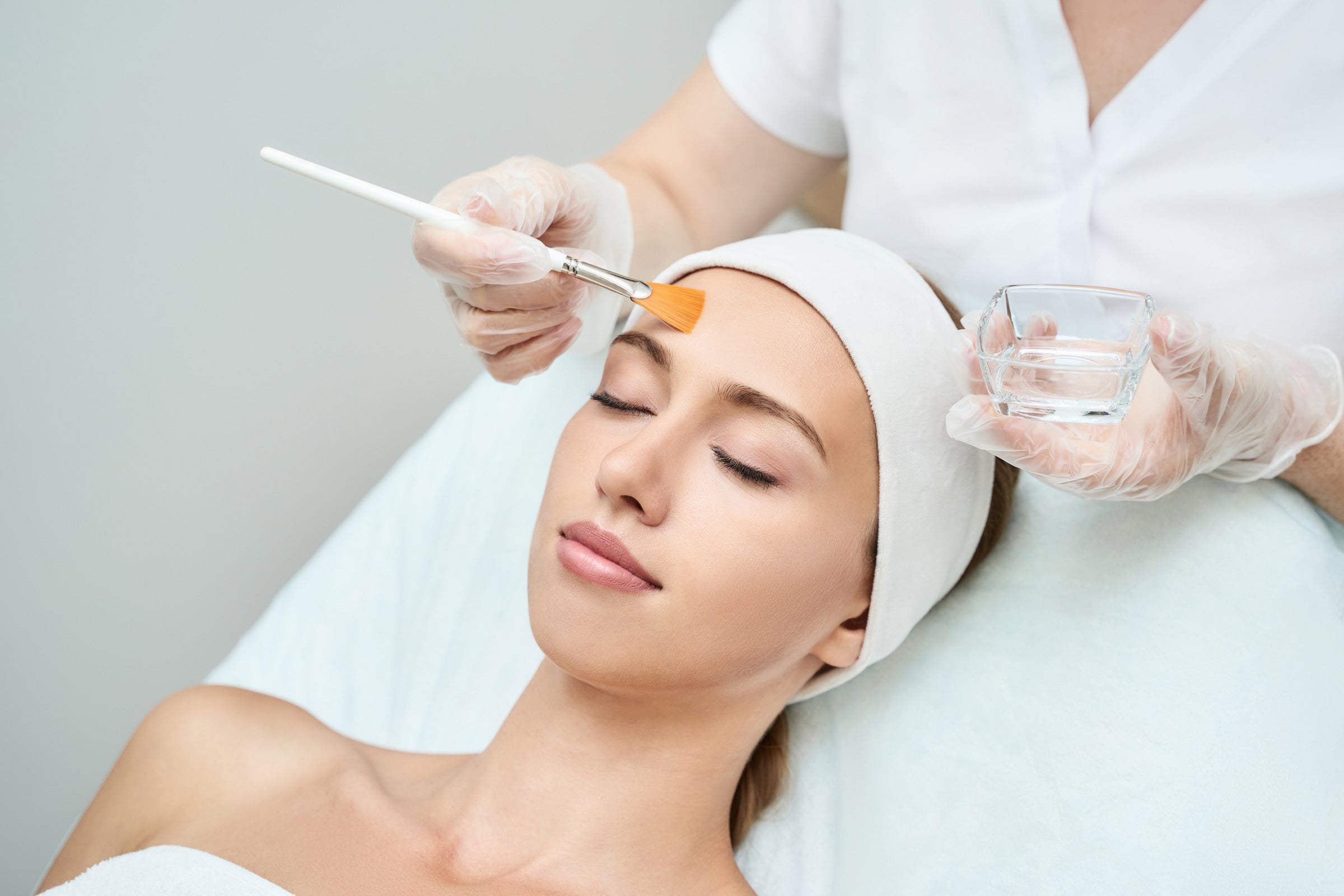 Microblading removal with chemical peels