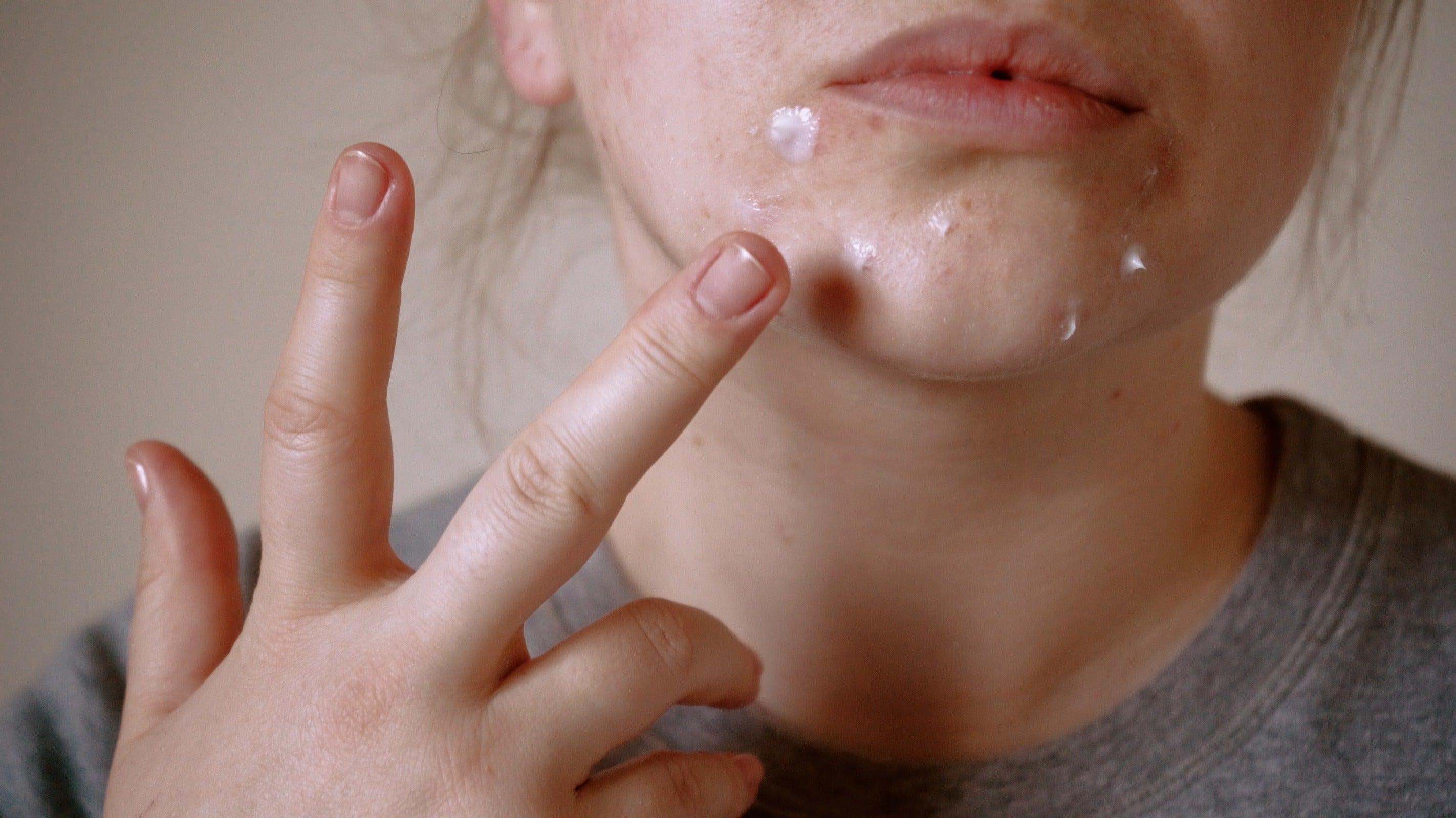 Natural Ways To Treat Bumpy Skin Irritation