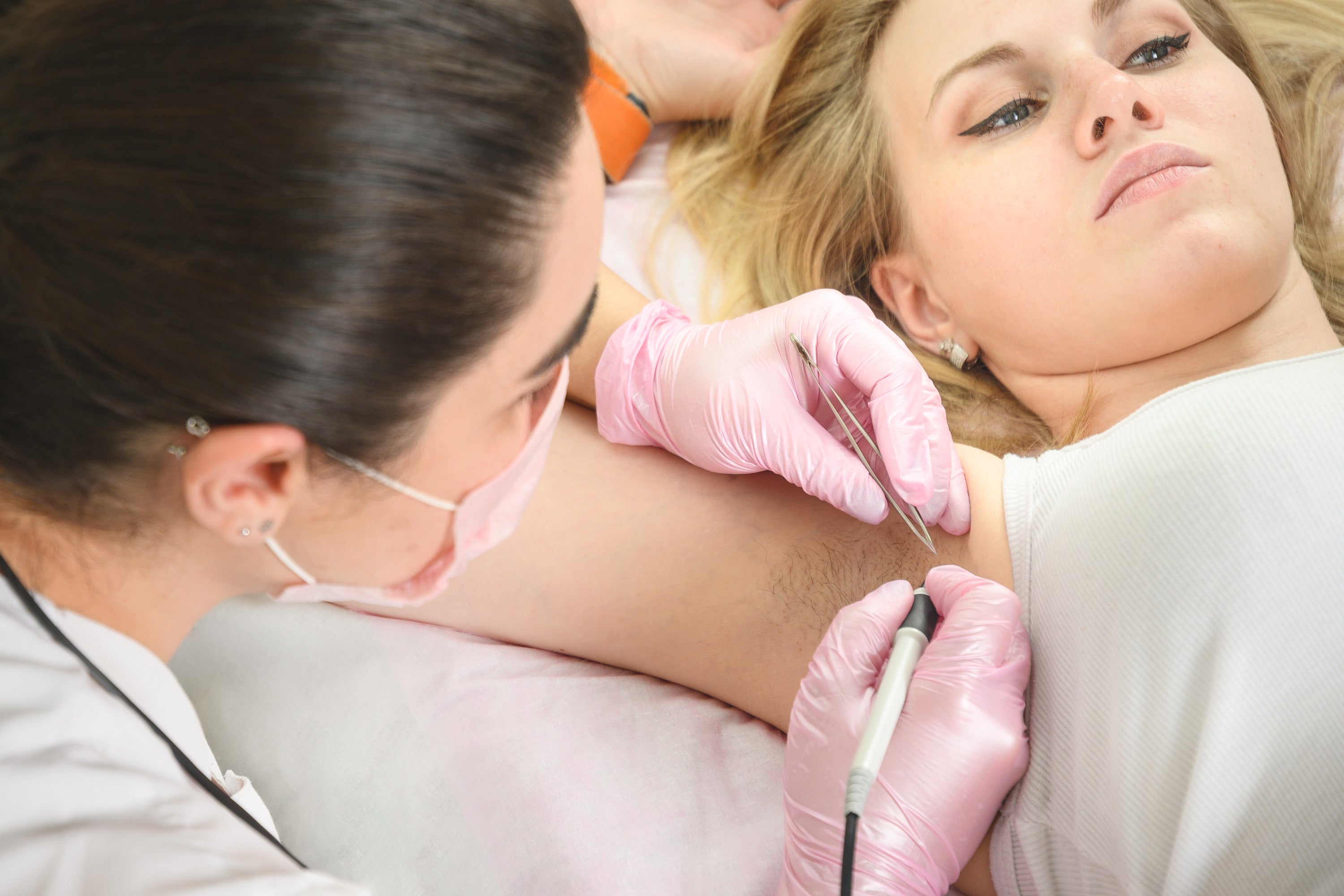 The Needle Electrolysis Hair Removal Process