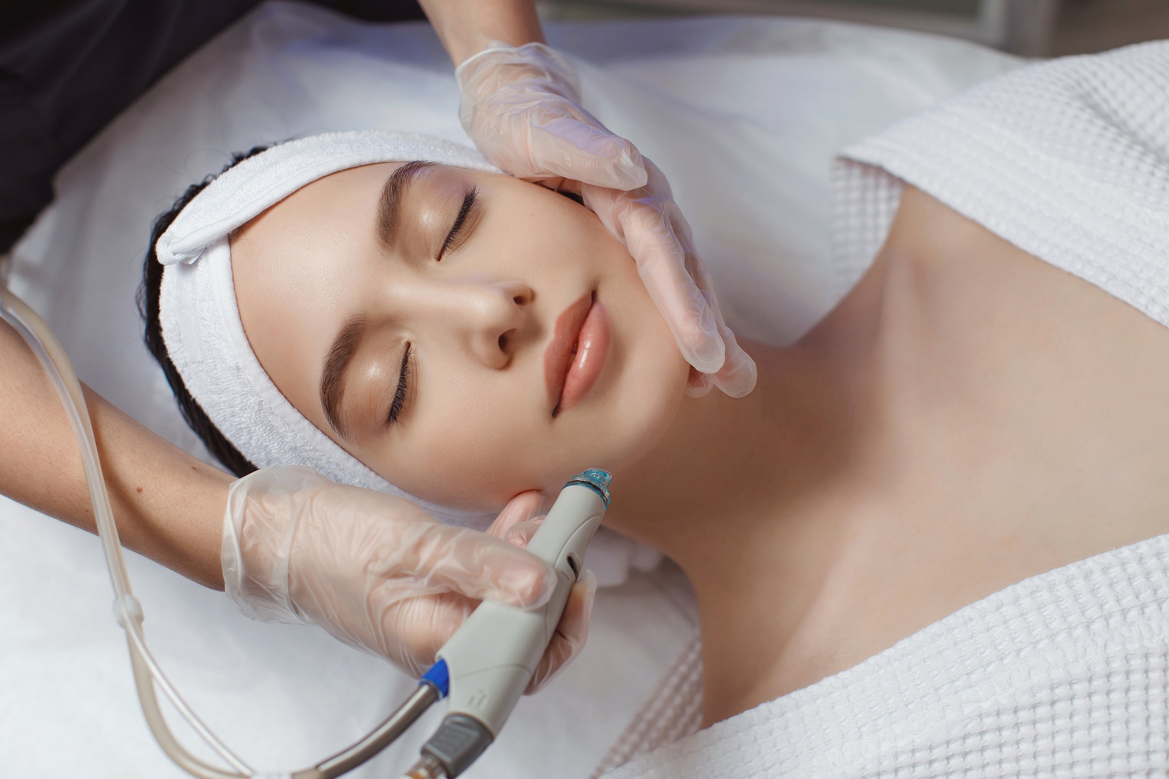 Only the superficial skin layers benefit from microdermabrasion