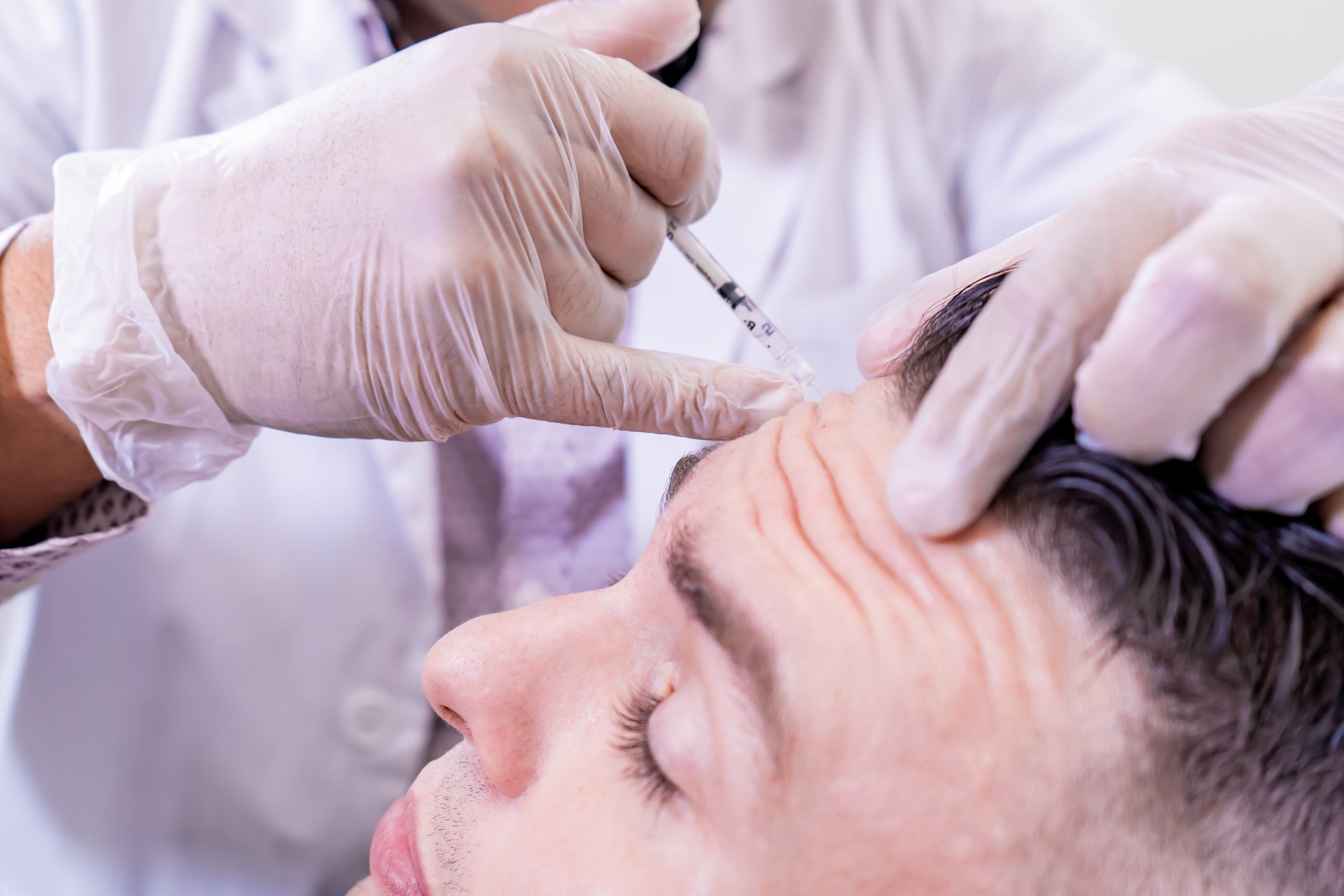 Long-Term Effects of Botox on Migraine Frequency