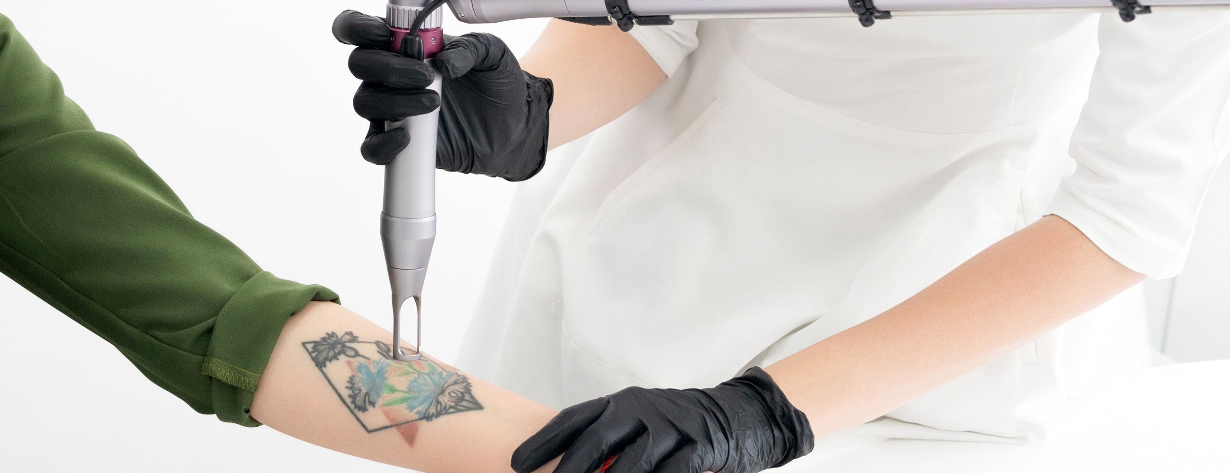 Laser tattoo removal removes painful scars