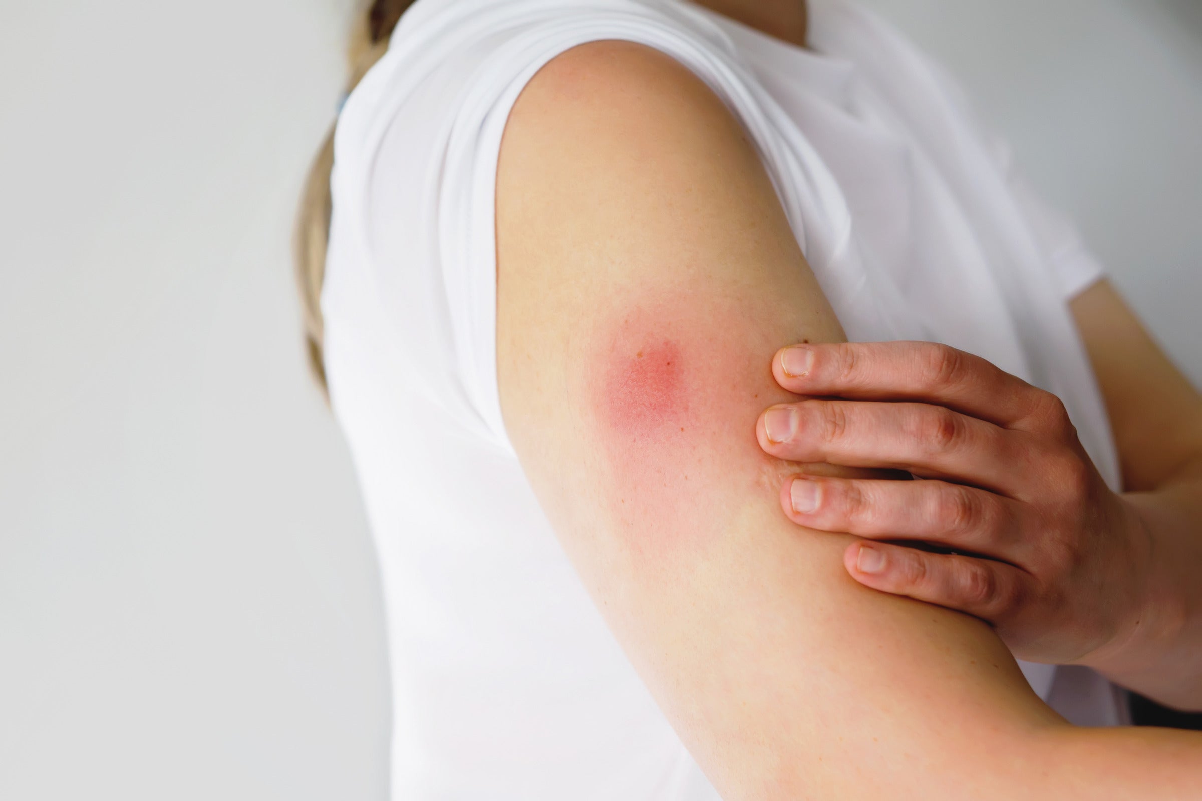 7 Side Effects of Allergy Shots for Adults