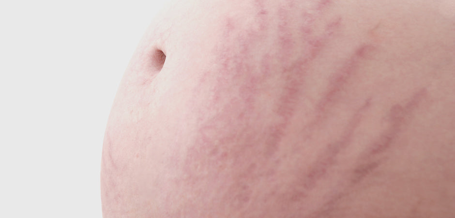 Skin Irritation During Pregnancy: 16 Common Conditions