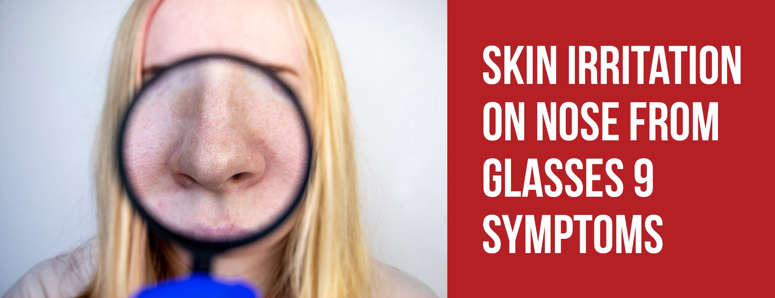 The symptoms of skin irritation caused by glasses on the nose