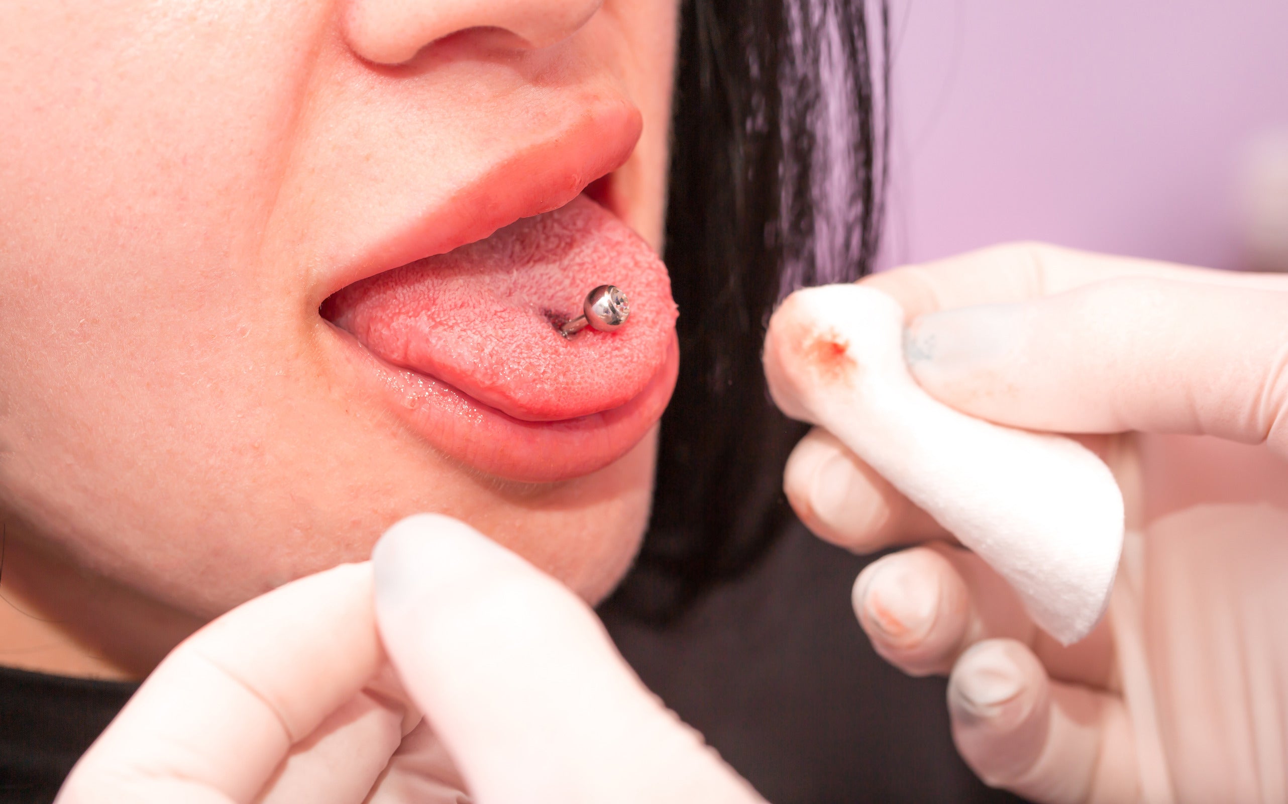 5 Symptoms of an Infected Tongue Piercing