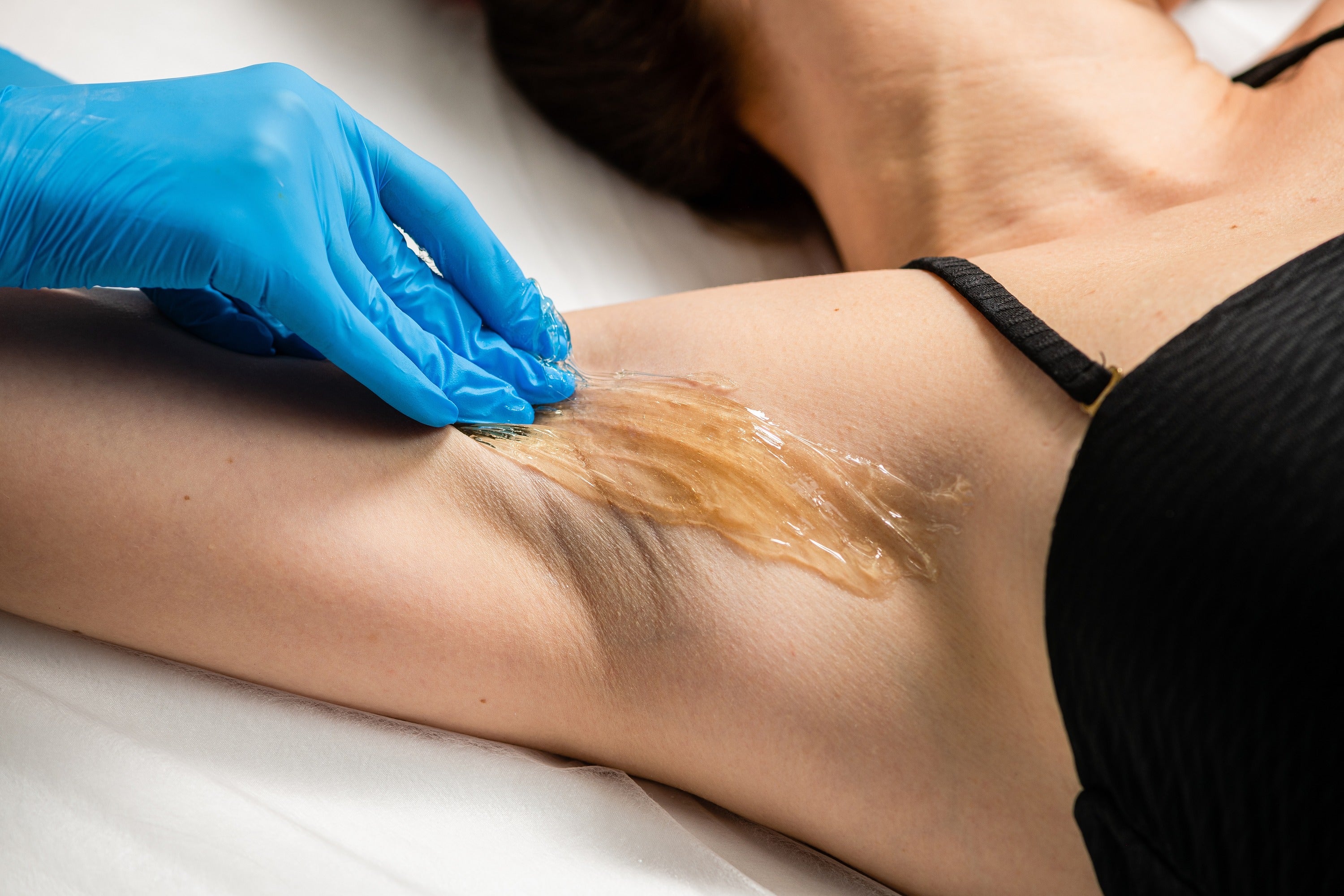 The Coarseness of Hair Affects Armpit Wax Pain