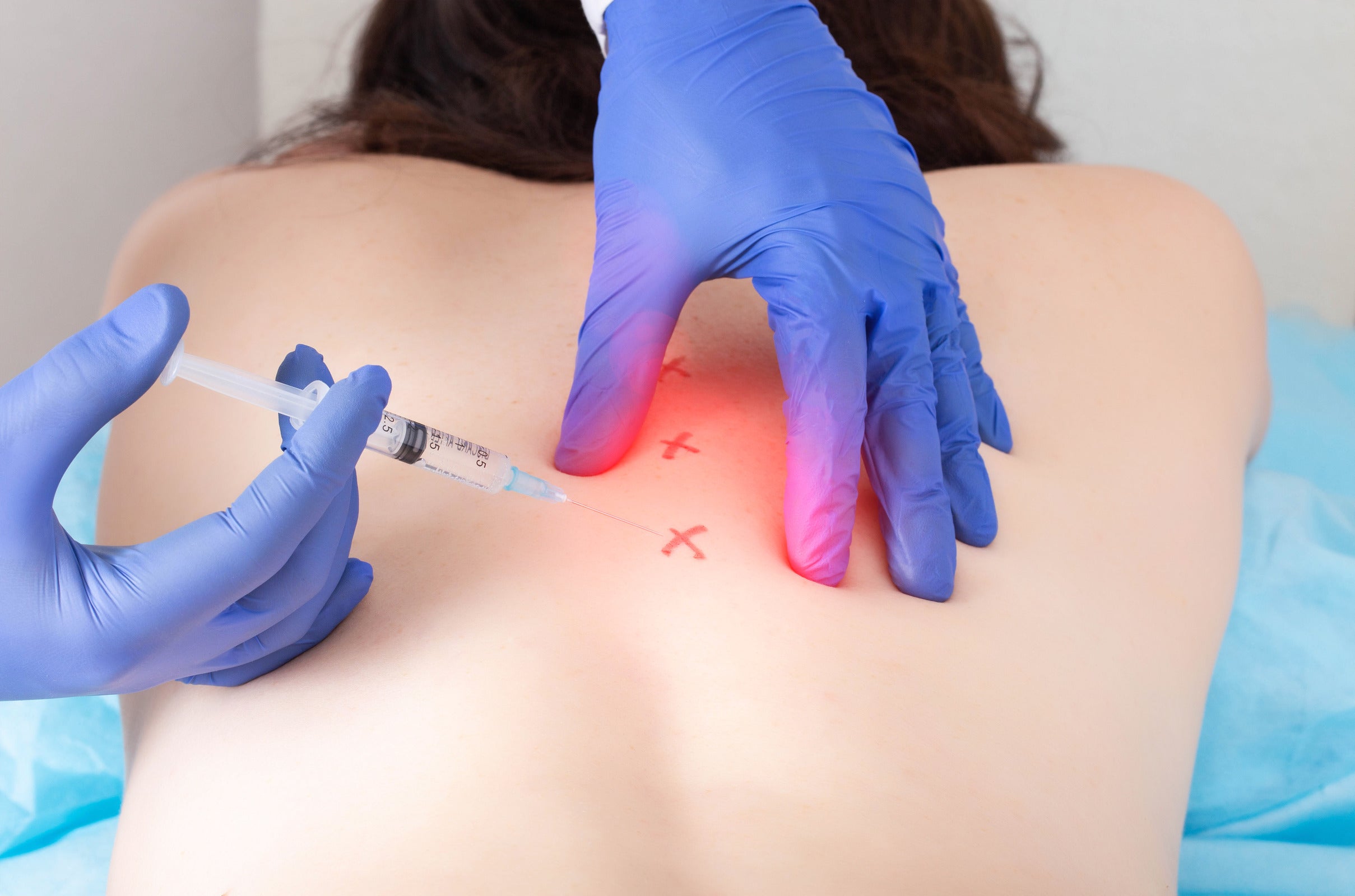 Spinal Anesthesia Medication Pre-Procedure Review