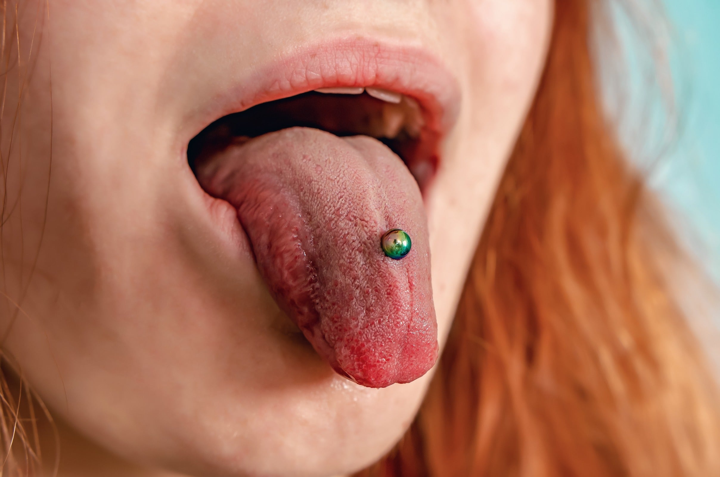 Causes of Tongue Piercing Bump