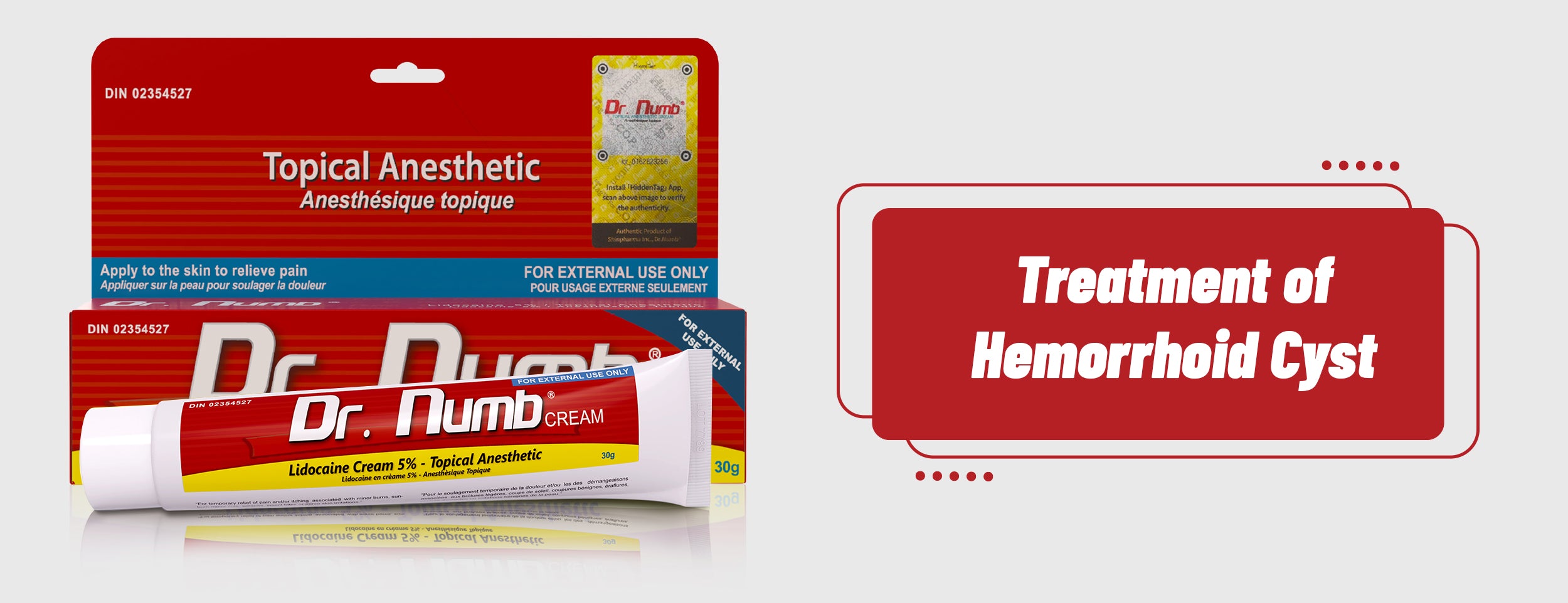 How to Treat a Hemorrhoid Cyst