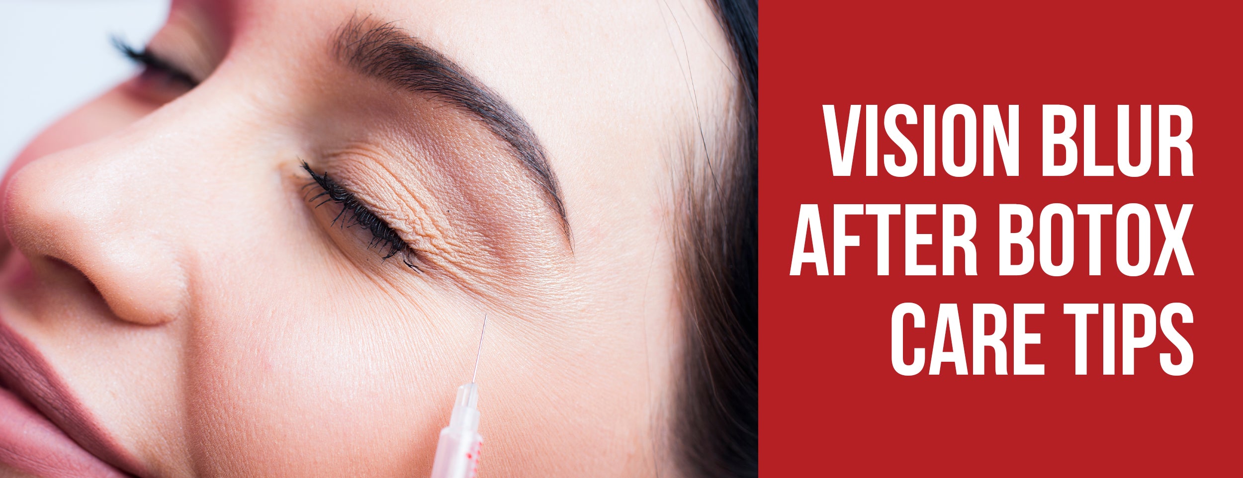 Vision Blur After Botox: Care Tips