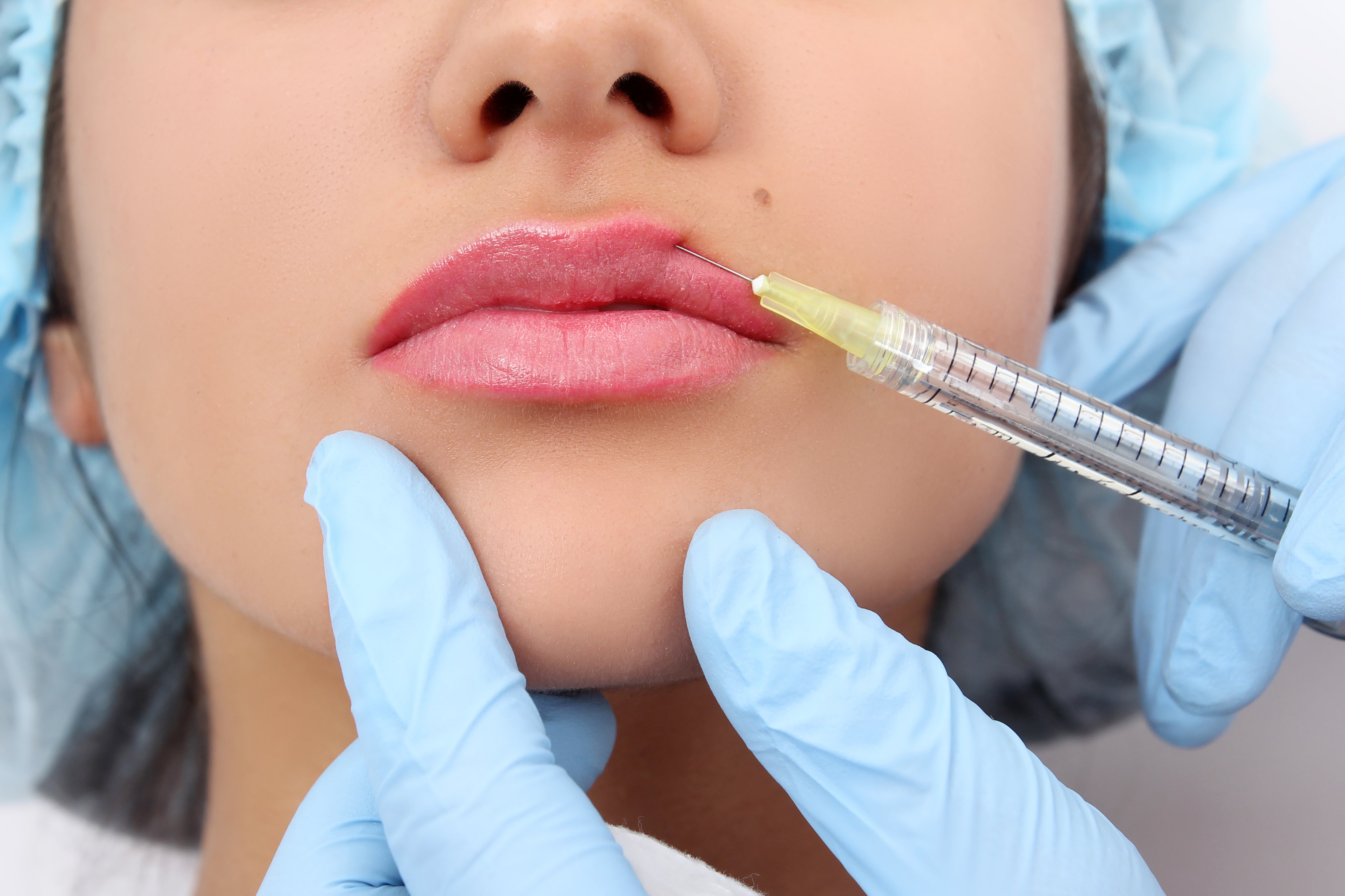 The 7 Benefits of Lip Injections with Long-Lasting Results