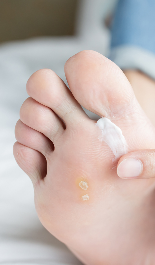 Why Is the Skin on My Feet So Dry and Flaky? | Weil Foot & Ankle Institute
