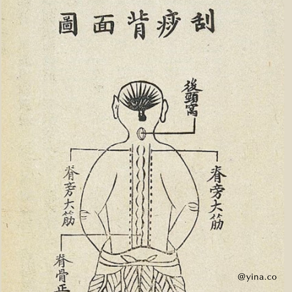 Qing Dynasty Gua Sha Illustration