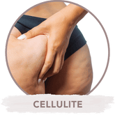 Microneedling gegen Cellulite