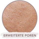 Erweiterte Poren