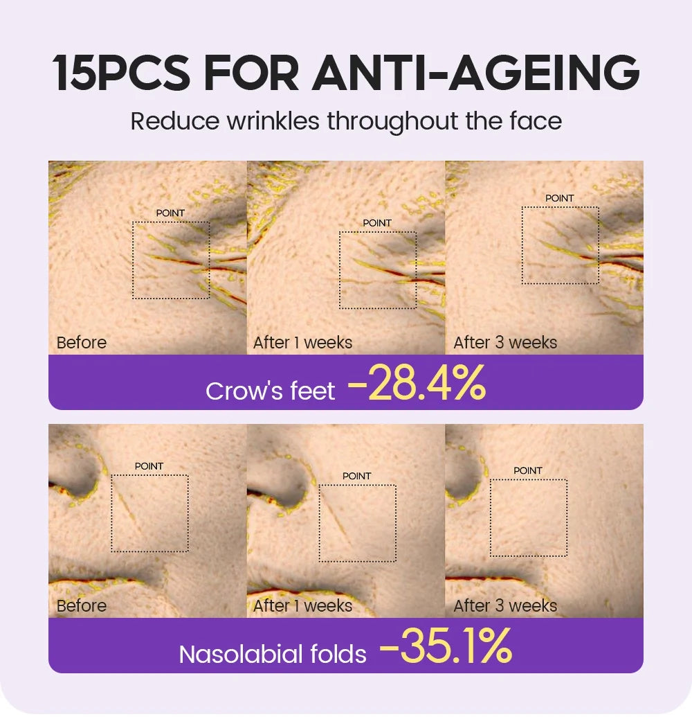 Anti_ageing_wrinkle_reduction_test_results