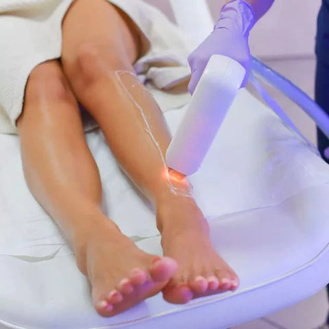 laser hair removal montreal