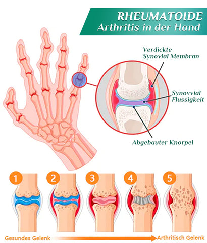 Futusly™ Turmalin Arthro- und Knochentherapie-Armband