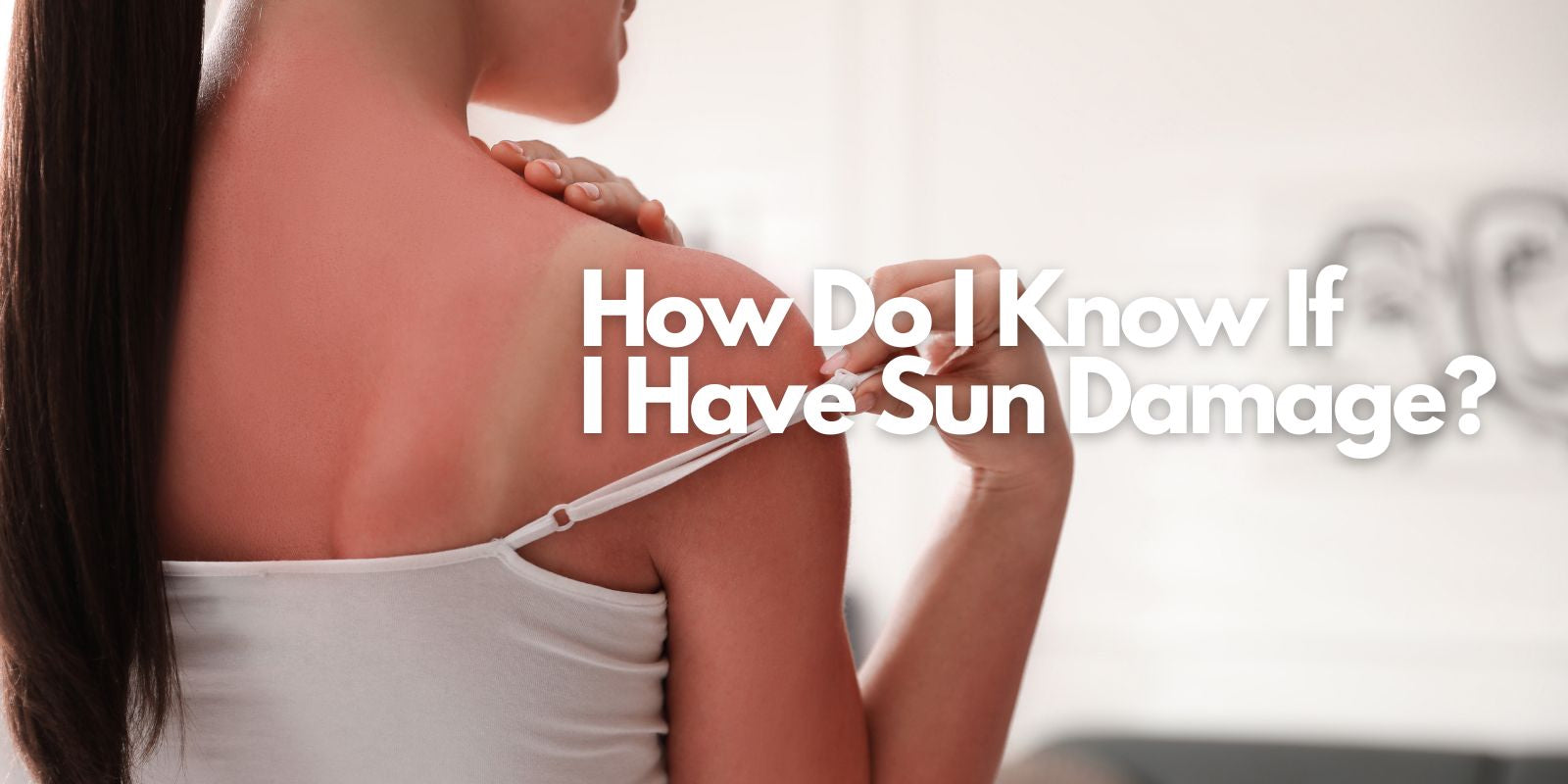 how do i know if i have sun damage? Greater Victoria Canada