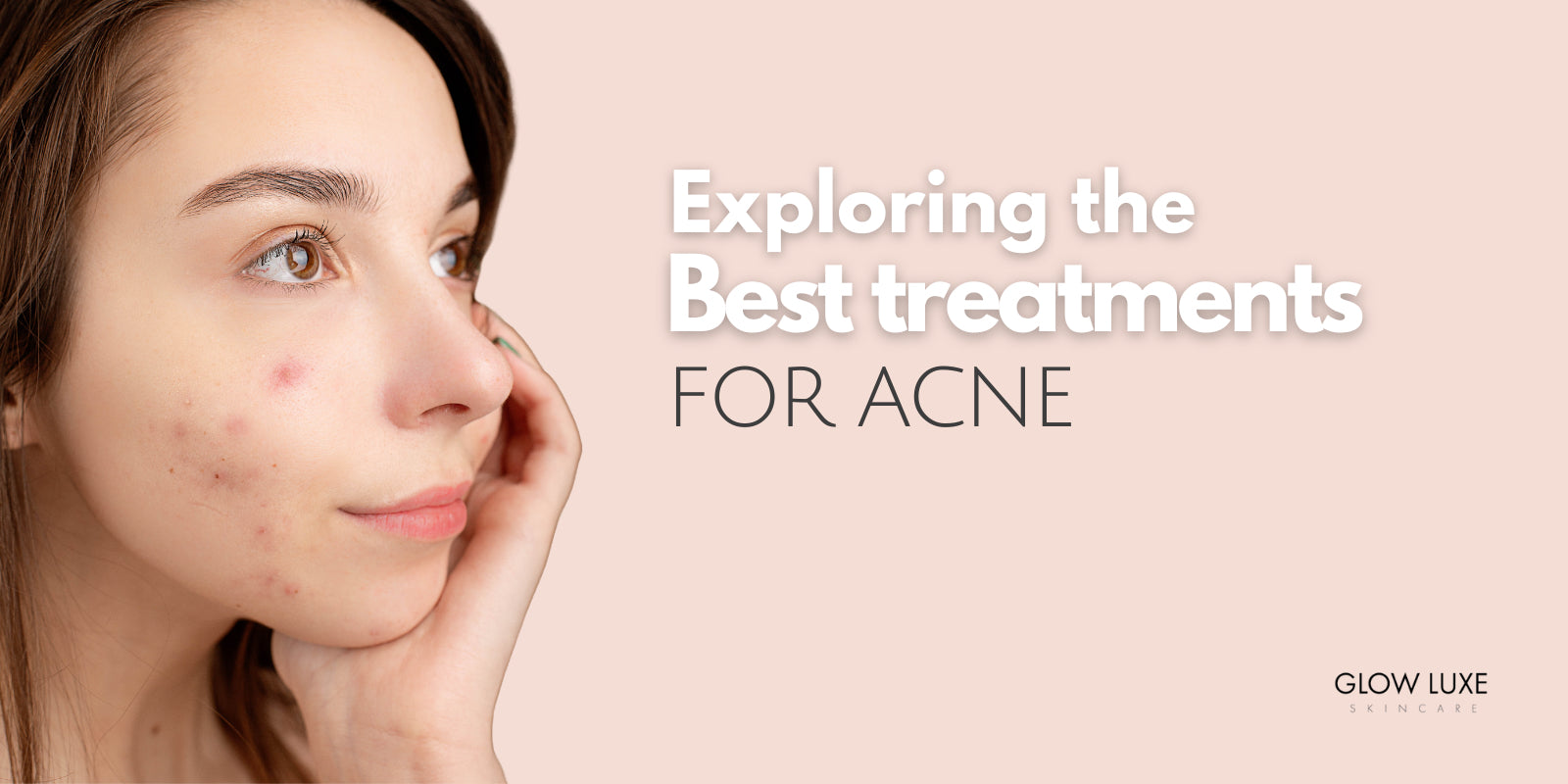 what is the best facial treatment for acne? Victoria BC