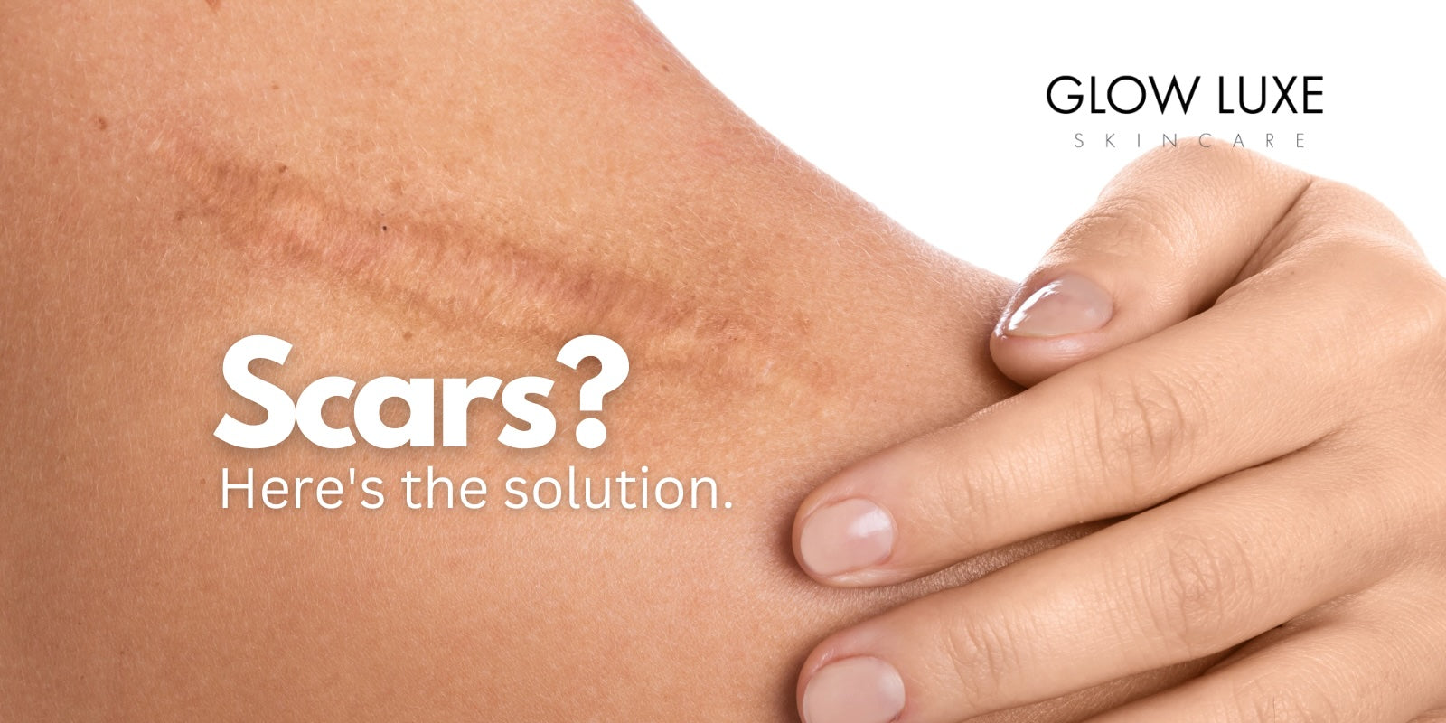 Morpheus8 and treatments better than Morpheus8. Treatment for scars.