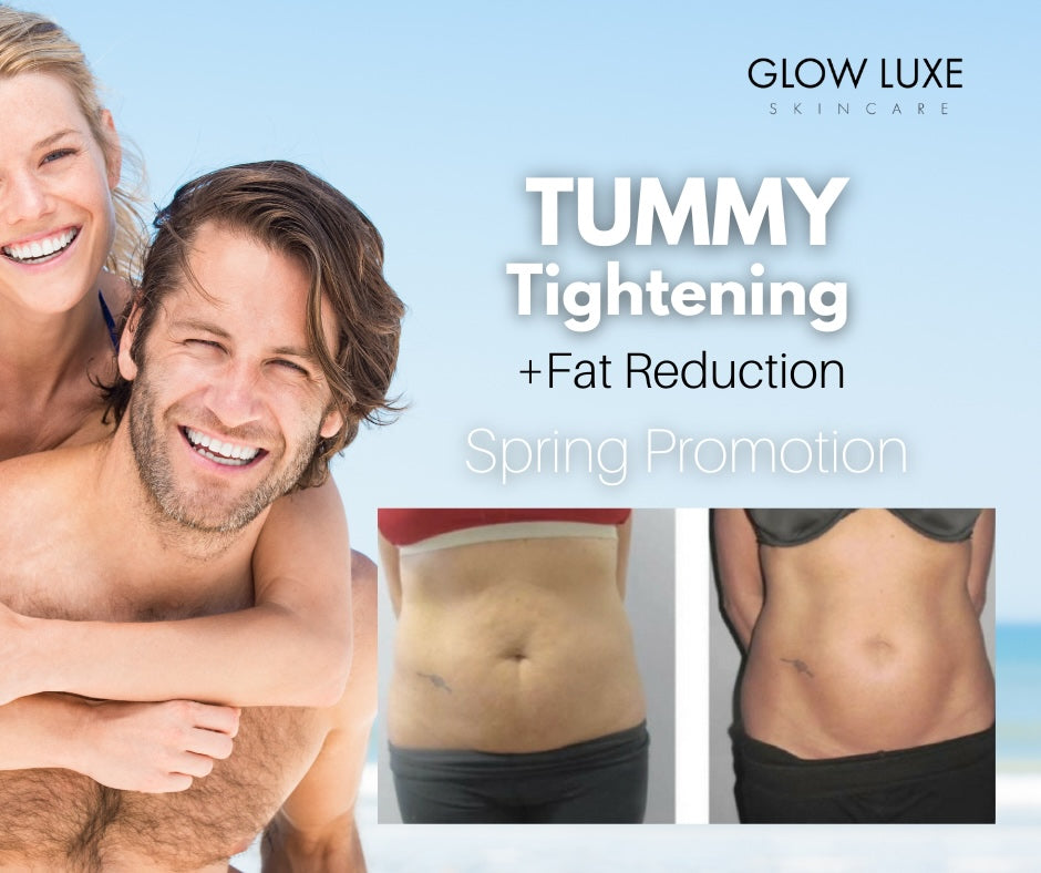 tummy tightening, coolsculpting, skin tightening and fat reduction promotion