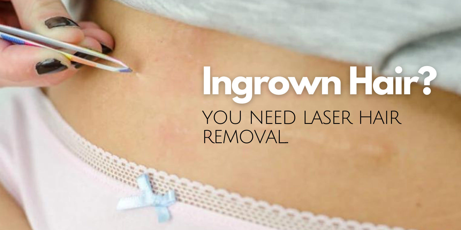 treatment for ingrown hair. ingrown hair Victoria BC. Prevent ingrown hair.