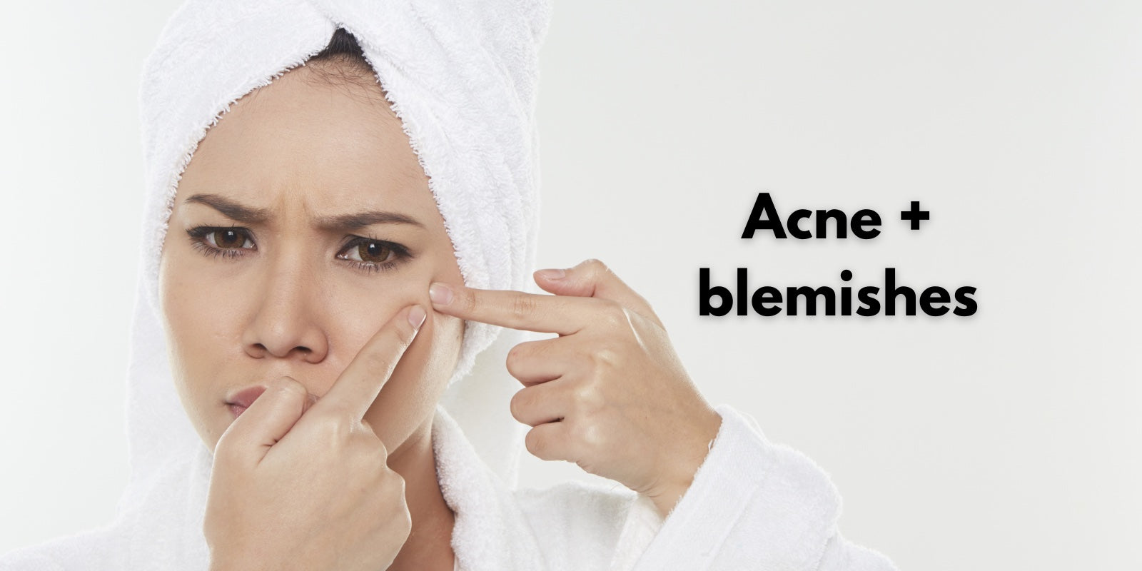 menopause and adult acne