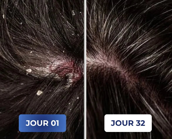 Problème de peau