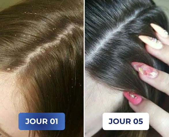 Problème de peau