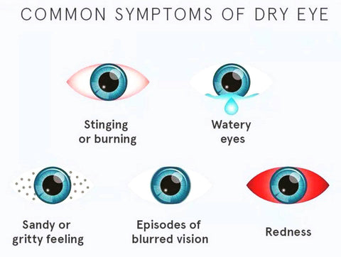 common symptoms of dry eye syndrome