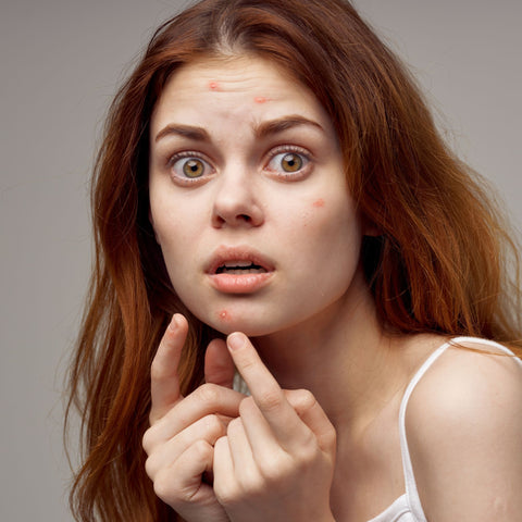 Understanding Infected Pimples on the Face