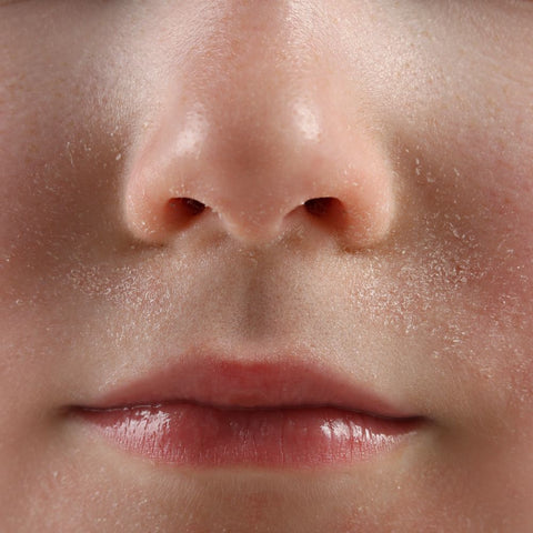 Common Causes of Dry Skin Around Nose