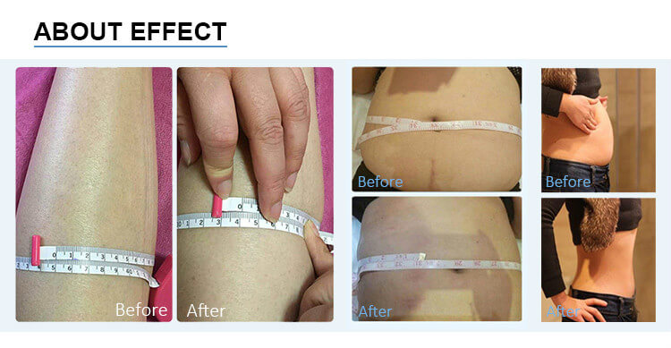 80K Cavitation Slimming Machine Effect