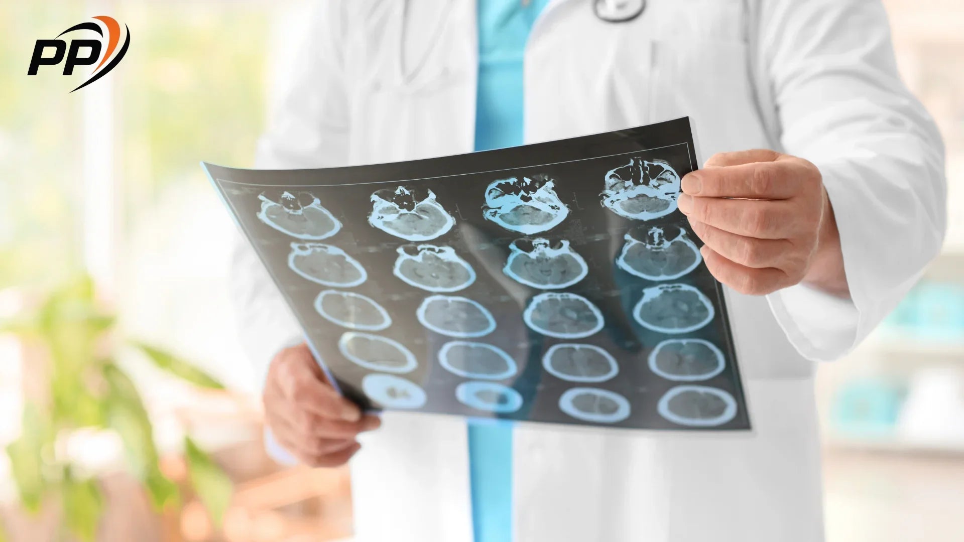 Actovegin în neurologie - Pen Peptide