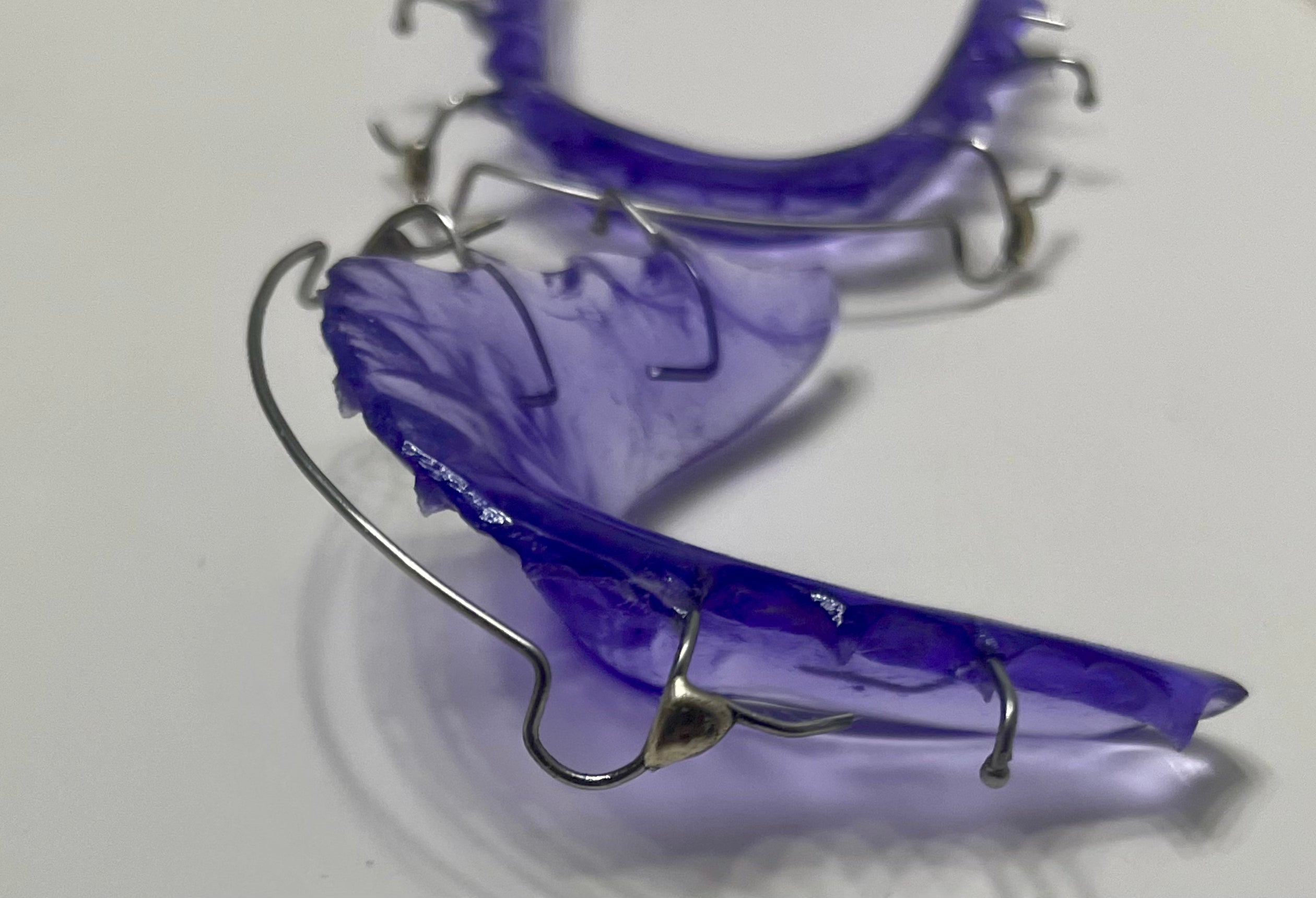 Custom Retainer with Soldered C Clasps